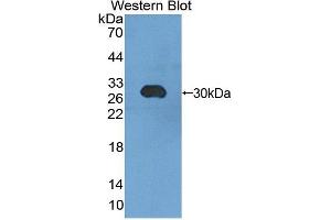 Western blot analysis of the recombinant protein. (CHGB Antikörper  (AA 448-664))