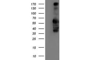 Western Blotting (WB) image for anti-Iduronate 2-Sulfatase (IDS) antibody (ABIN1498798)