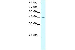 WB Suggested Anti-HMG20A Antibody Titration:  0. (HMG20A Antikörper  (Middle Region))
