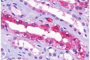 Anti-GPR91 antibody  ABIN1048899 IHC staining of human kidney, medulla. (SUCNR1 Antikörper  (Cytoplasmic Domain))