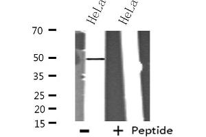Western blot analysis of extracts from HeLa cells using ITPK1 antibody. (ITPK1 Antikörper  (Internal Region))