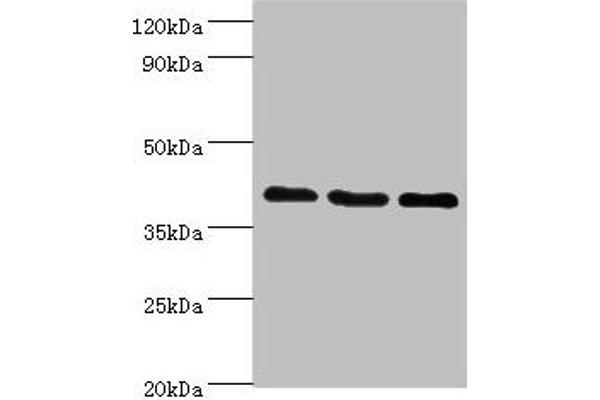 GPRC5A Antikörper  (AA 258-357)