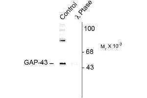 Western blots of rat cortex lysate showing specific immunolabeling of the ~50k Gap-43 protein phosphorylated at Ser41 (Control). (GAP43 Antikörper  (pSer41))