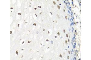 Immunohistochemistry of paraffin-embedded Human esophagus using CNOT8 Polyclonal Antibody at dilution of 1:100 (40x lens). (CNOT8 Antikörper)