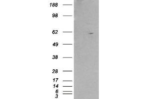 Western Blotting (WB) image for anti-Retinoid X Receptor, beta (RXRB) antibody (ABIN5876651) (Retinoid X Receptor beta Antikörper)