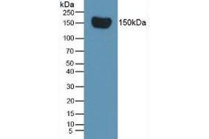 Mouse Capture antibody from the kit in WB with Positive Control: Rat Serum.
