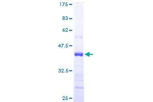 Image no. 1 for Cystatin E/M (CST6) (AA 29-149) protein (GST tag) (ABIN1350587)
