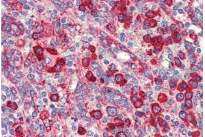 Human Spleen (formalin-fixed, paraffin-embedded) stained with HSP90B1 antibody ABIN462106 at 10 ug/ml followed by biotinylated secondary antibody, alkaline phosphatase-streptavidin and chromogen. (GRP94 Antikörper)