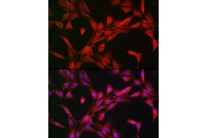 Immunofluorescence analysis of NIH-3T3 cells using p70 S6 Kinase 1 1 Rabbit pAb (ABIN3023168, ABIN3023169, ABIN3023170, ABIN1513490 and ABIN6219422) at dilution of 1:100 (40x lens). (RPS6KB1 Antikörper  (AA 1-352))