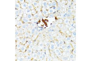 Immunohistochemistry of paraffin-embedded mouse liver using alpha 1 Spectrin antibody (ABIN6129333, ABIN6148401, ABIN6148402 and ABIN6215956) at dilution of 1:100 (40x lens). (SPTA1 Antikörper  (AA 940-1160))