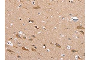 The image on the left is immunohistochemistry of paraffin-embedded Human brain tissue using ABIN7130278(MSMB Antibody) at dilution 1/30, on the right is treated with fusion protein. (MSMB Antikörper)
