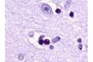 Anti-EDG2 antibody IHC of human brain, neuron and glia. (LPAR1 Antikörper  (Cytoplasmic Domain))
