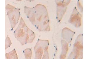 Detection of IL18 in Rat Skeletal muscle Tissue using Polyclonal Antibody to Interleukin 18 (IL18) (IL-18 Antikörper  (AA 37-194))