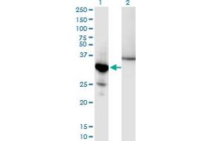 Western Blot analysis of NFKBIA expression in transfected 293T cell line by NFKBIA monoclonal antibody (M10), clone 3H4. (NFKBIA Antikörper  (AA 1-317))