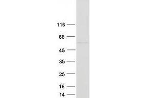 Western Blotting (WB) image for Hyaluronidase-1 (HYAL1) (Transcript Variant 7) protein (Myc-DYKDDDDK Tag) (ABIN2723133)