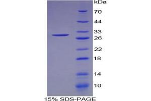 SDS-PAGE analysis of Human MEPE Protein. (MEPE Protein)