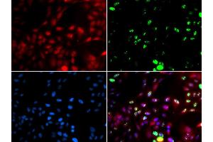 Immunofluorescence analysis of GFP-RNF168 transgenic U2OS cells using POLK antibody (ABIN5973607). (POLK Antikörper)