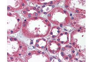 Immunohistochemistry (IHC) image for anti-TBC1 (Tre-2/USP6, BUB2, Cdc16) Domain Family, Member 1 (TBC1D1) (Middle Region) antibody (ABIN2786087)