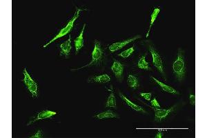Immunofluorescence of purified MaxPab antibody to DAXX on HeLa cell. (DAXX Antikörper  (AA 1-740))