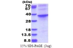 SDS-PAGE (SDS) image for Aspartate beta-Hydroxylase Domain Containing 1 (ASPHD1) (AA 96-390) protein (His tag) (ABIN5853766) (ASPHD1 Protein (AA 96-390) (His tag))