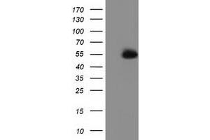 HEK293T cells were transfected with the pCMV6-ENTRY control (Left lane) or pCMV6-ENTRY SNTA1 (Right lane) cDNA for 48 hrs and lysed. (SNTA1 Antikörper)