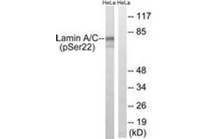 Western blot analysis of extracts from HeLa cells treated with paclitaxel 1uM 24h, using Lamin A (Phospho-Ser22) Antibody. (Lamin A/C Antikörper  (pSer22))