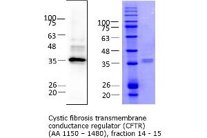 Quality Control Images: Western Blotting + SDS-PAGE (CFTR Protein (AA 1152-1480) (His tag))