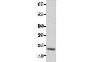Western Blotting (WB) image for anti-Cardiac Troponin C (TNNC1) (AA 1-18), (N-Term) antibody (ABIN3043055)