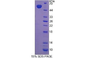 SDS-PAGE analysis of Rat ABCC11 Protein.