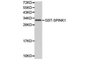 Western Blotting (WB) image for anti-serine Peptidase Inhibitor, Kazal Type 1 (SPINK1) antibody (ABIN1874923) (SPINK1 Antikörper)