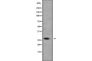 Western blot analysis of SLC25A27 expression in 293T cell lysate,The lane on the left is treated with the antigen-specific peptide. (SLC25A27 Antikörper  (C-Term))