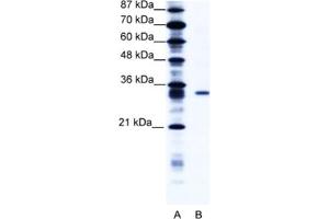 Western Blotting (WB) image for anti-Kv Channel Interacting Protein 4 (KCNIP4) antibody (ABIN2461007)