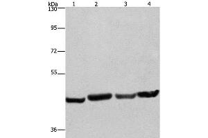 Western Blot analysis of A549, Hela, PC3 and HepG2 cell using RBMY1A1 Polyclonal Antibody at dilution of 1:360 (RBMY1A1 Antikörper)