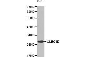 Western blot analysis of extracts of 293T cell line, using CLEC4D antibody. (CLEC4D Antikörper  (AA 39-215))