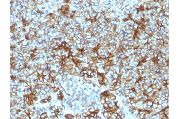 Spectrin, Beta, Non-erythrocytic 2 (SPTBN2) (AA 356-475) Antikörper