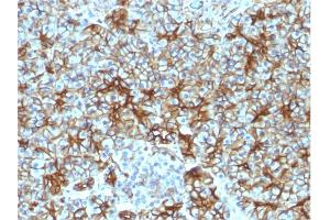 Formalin-fixed, paraffin-embedded human Pancreas stained with Spectrin beta III Monoclonal Antibody (SPTBN2/1583).