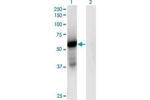 Western Blot analysis of GPT2 expression in transfected 293T cell line by GPT2 monoclonal antibody (M04), clone 7A11. (GPT2 Antikörper  (AA 358-456))