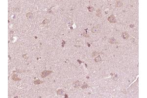 Immunohistochemistry (Paraffin-embedded Sections) (IHC (p)) image for anti-ATPase, Cu++ Transporting, alpha Polypeptide (ATP7A) (AA 242-285) antibody (ABIN731513)
