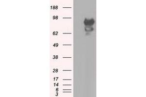 Western Blotting (WB) image for anti-Sorting Nexin 9 (SNX9) antibody (ABIN1501050) (SNX9 Antikörper)