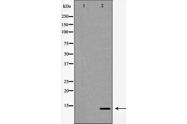 beta Synuclein Antikörper  (C-Term)