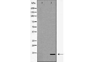 Western blot analysis of Synuclein β expression in HeLa cell lysate. (beta Synuclein Antikörper  (C-Term))