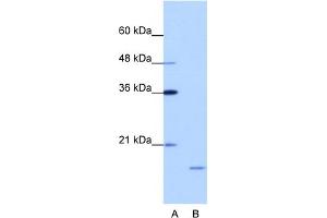 WB Suggested Anti-ISG20 Antibody Titration:  1. (ISG20 Antikörper  (N-Term))