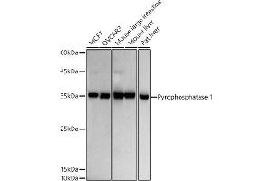Western blot analysis of extracts of various cell lines, using Pyrophosphatase 1 antibody (ABIN7269762) at 1:500 dilution. (Pyrophosphatase (Inorganic) 1 (PPA1) Antikörper)