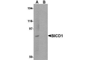 Image no. 1 for anti-Bicaudal D Homolog 1 (BICD1) (C-Term) antibody (ABIN1492179) (BICD1 Antikörper  (C-Term))