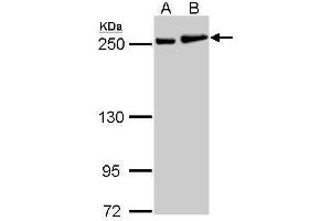 WB Image MYH9 antibody [N1], N-term detects MYH9 protein by Western blot analysis. (Myosin 9 Antikörper  (N-Term))