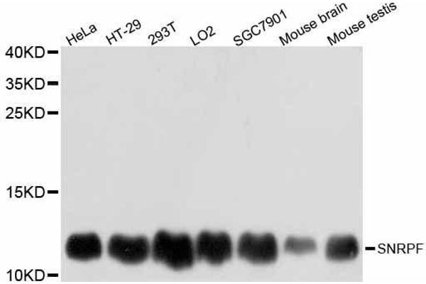 SNRPF Antikörper  (AA 1-86)