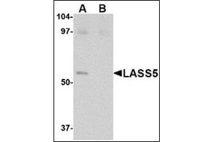 Western blot analysis of LASS5 in SK-N-SH lysate with this product at 1 μg/ml in the (A) absence and (B) presence of blocking peptide.