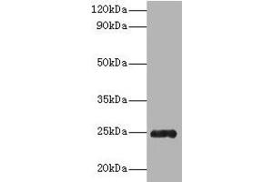 Western blot All lanes: Trypsin antibody at 2 μg/mL + Recombinant Pig Trypsin protein 1 μg Secondary Goat polyclonal to rabbit IgG at 1/10000 dilution Predicted band size: 25 kDa Observed band size: 25 kDa (Trypsin Antikörper  (AA 9-231))