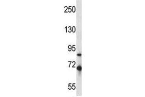 Irak1 antibody western blot analysis in mouse Neuro-2a lysate. (IRAK1 Antikörper  (AA 405-433))