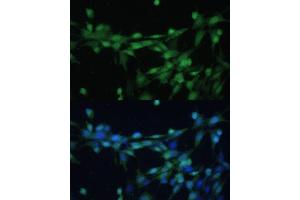 Immunofluorescence analysis of NIH-3T3 cells using Casein Kinase 2 beta (Casein Kinase 2 beta (CSNK2B)) Polyclonal Antibody (ABIN7266104) at dilution of 1:100 (40x lens). (CSNK2B Antikörper  (AA 1-215))